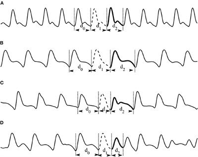 PPGSynth: An Innovative Toolbox for Synthesizing Regular and Irregular Photoplethysmography Waveforms